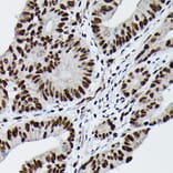 Immunohistochemistry - Anti-c-Jun (phospho Ser73) Antibody (A16448) - Antibodies.com