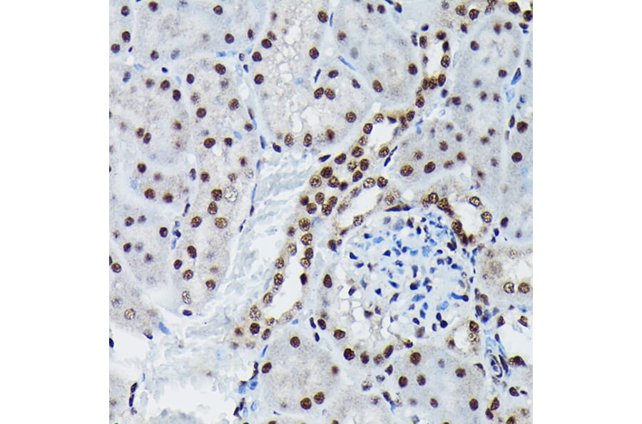 Immunohistochemistry - Anti-c-Jun (phospho Ser73) Antibody (A16448) - Antibodies.com