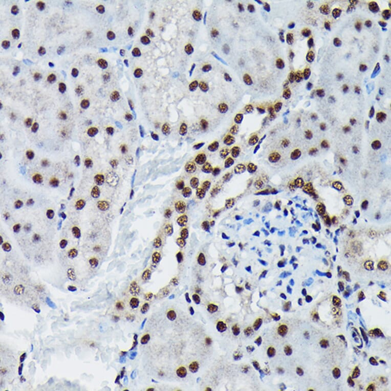 Immunohistochemistry - Anti-c-Jun (phospho Ser73) Antibody (A16448) - Antibodies.com