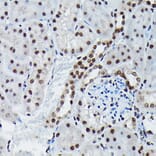 Immunohistochemistry - Anti-c-Jun (phospho Ser73) Antibody (A16448) - Antibodies.com