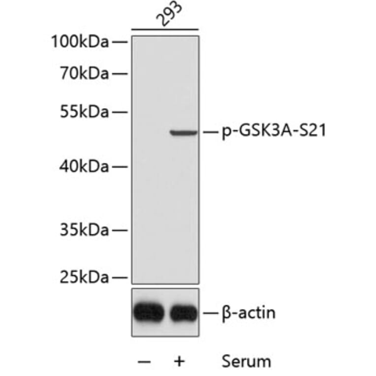 Western Blot - Anti-GSK3A (phospho S21) Antibody (AP0120) - Antibodies.com