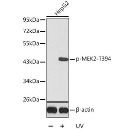 Western Blot - Anti-MEK2 (phospho Thr394) Antibody (A16450) - Antibodies.com