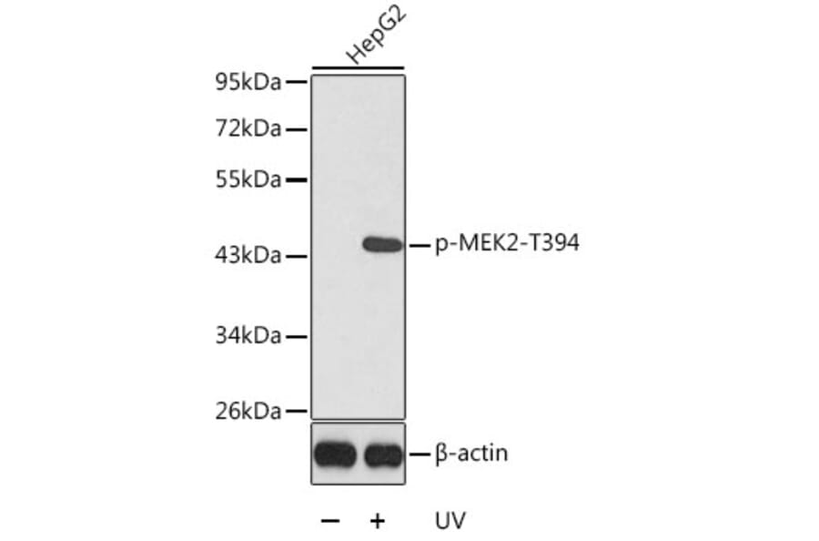 Western Blot - Anti-MEK2 (phospho Thr394) Antibody (A16450) - Antibodies.com