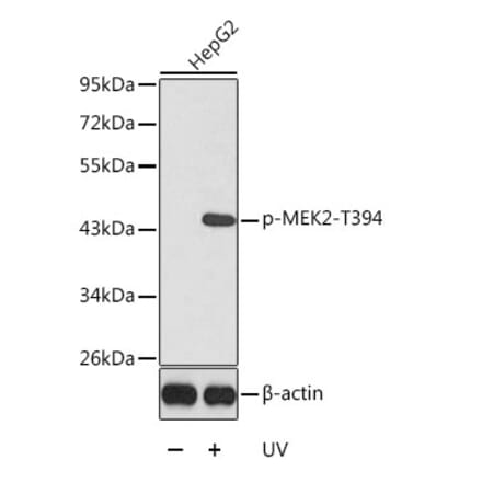 Western Blot - Anti-MEK2 (phospho Thr394) Antibody (A16450) - Antibodies.com