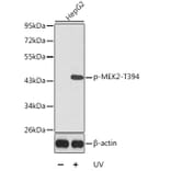 Western Blot - Anti-MEK2 (phospho Thr394) Antibody (A16450) - Antibodies.com