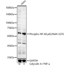 Western Blot - Anti-NF-kB p65 (phospho Ser276) Antibody (A16452) - Antibodies.com