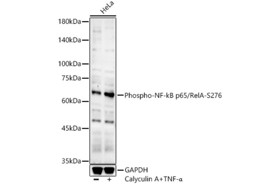 Western Blot - Anti-NF-kB p65 (phospho Ser276) Antibody (A16452) - Antibodies.com