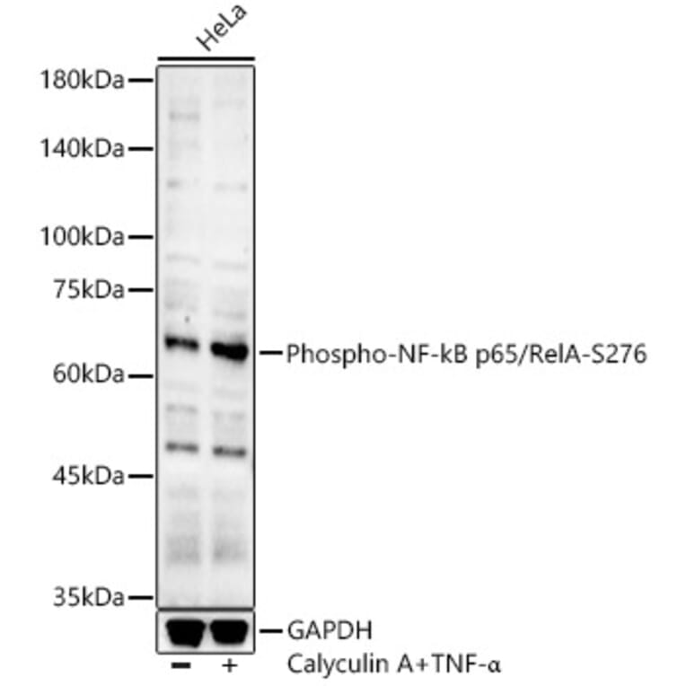 Western Blot - Anti-NF-kB p65 (phospho Ser276) Antibody (A16452) - Antibodies.com