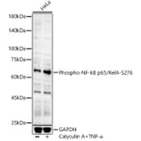 Western Blot - Anti-NF-kB p65 (phospho Ser276) Antibody (A16452) - Antibodies.com