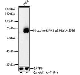 Western Blot - Anti-NF-kB p65 (phospho Ser536) Antibody (A16453) - Antibodies.com