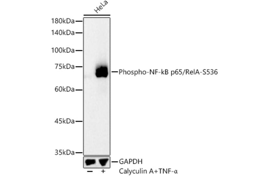 Western Blot - Anti-NF-kB p65 (phospho Ser536) Antibody (A16453) - Antibodies.com