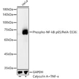 Western Blot - Anti-NF-kB p65 (phospho Ser536) Antibody (A16453) - Antibodies.com