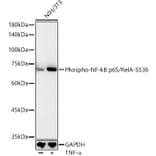 Western Blot - Anti-NF-kB p65 (phospho Ser536) Antibody (A16453) - Antibodies.com