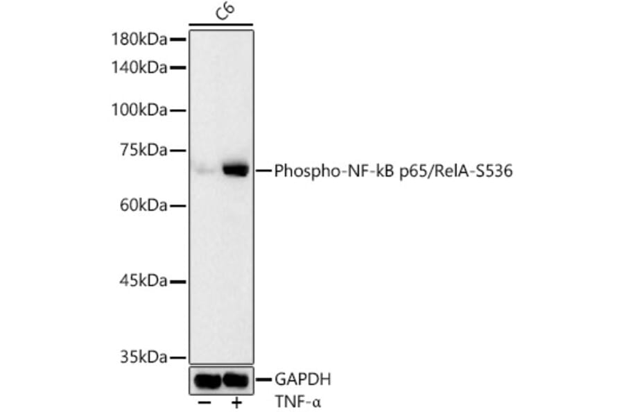 Western Blot - Anti-NF-kB p65 (phospho Ser536) Antibody (A16453) - Antibodies.com