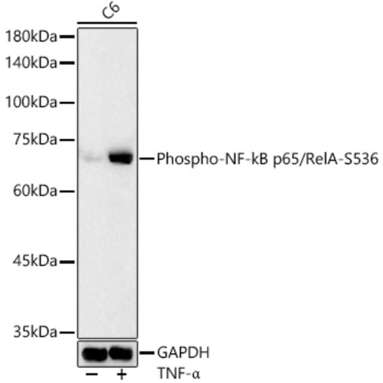 Western Blot - Anti-NF-kB p65 (phospho Ser536) Antibody (A16453) - Antibodies.com