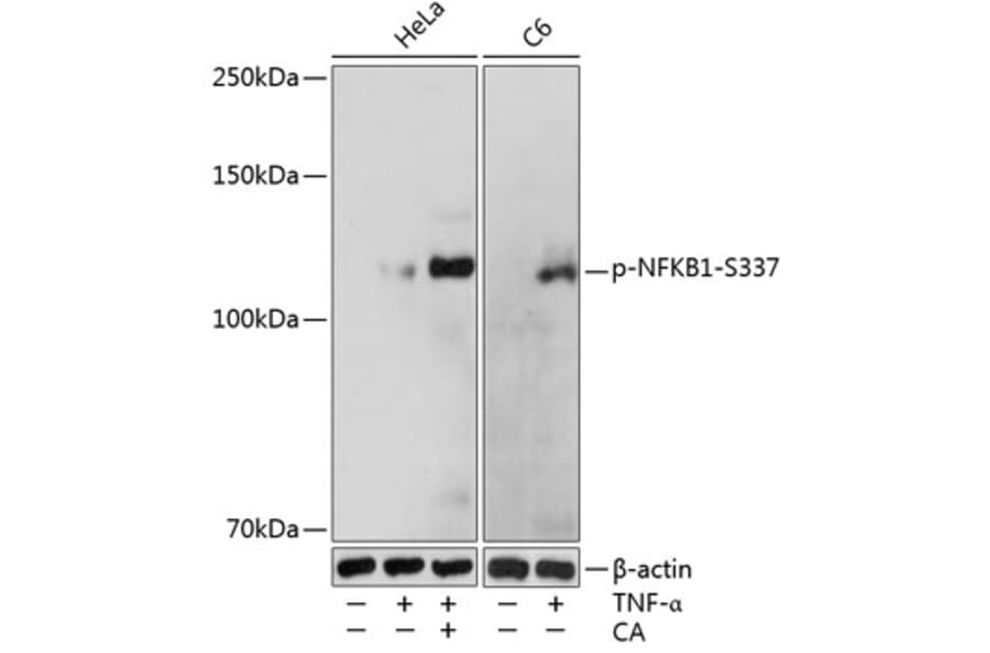 Western Blot - Anti-NFkB p105/p50 (phospho Ser337) Antibody (A16454) - Antibodies.com