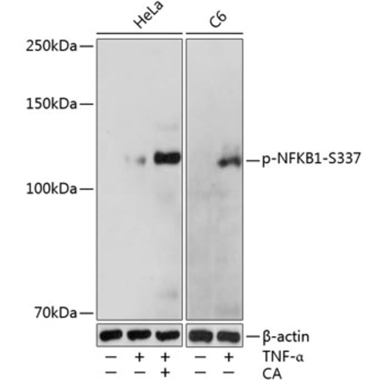 Western Blot - Anti-NFkB p105 / p50 (phospho Ser337) Antibody (A16454) - Antibodies.com