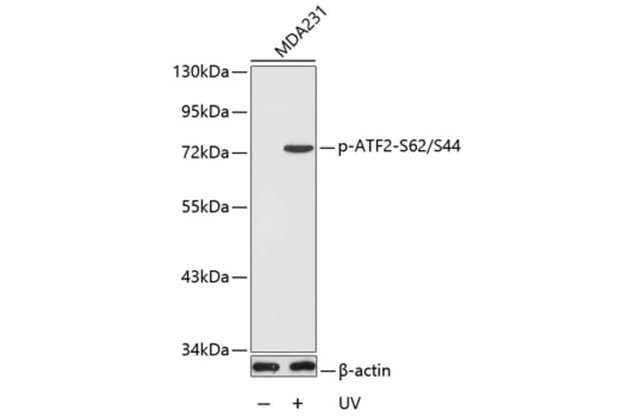 Western Blot - Anti-ATF2 (phospho S62 + S44) Antibody (AP0127) - Antibodies.com