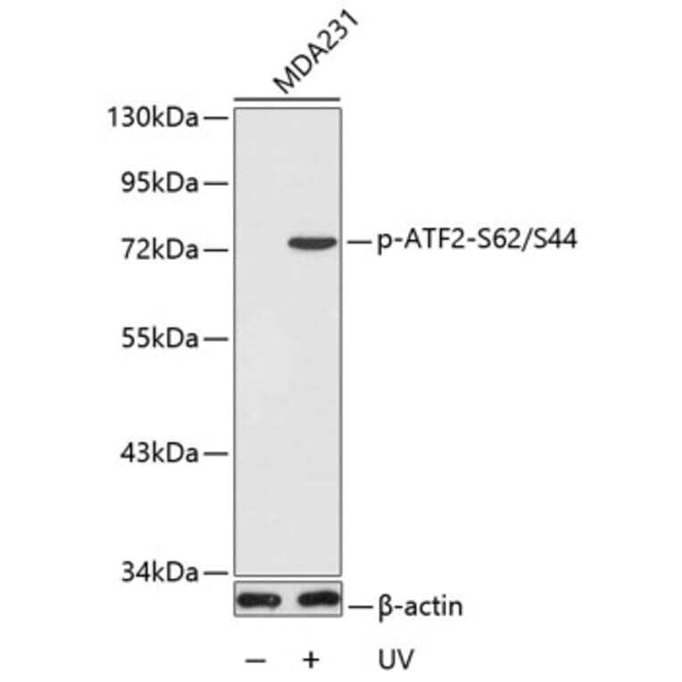 Western Blot - Anti-ATF2 (phospho S62 + S44) Antibody (AP0127) - Antibodies.com