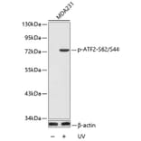 Western Blot - Anti-ATF2 (phospho S62 + S44) Antibody (AP0127) - Antibodies.com