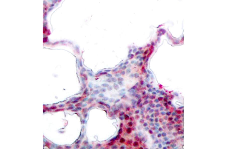 Immunohistochemistry - Anti-ATF2 (phospho S62 + S44) Antibody (AP0127) - Antibodies.com