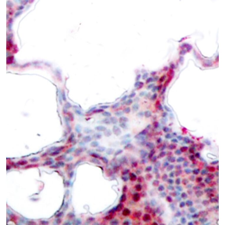 Immunohistochemistry - Anti-ATF2 (phospho S62 + S44) Antibody (AP0127) - Antibodies.com