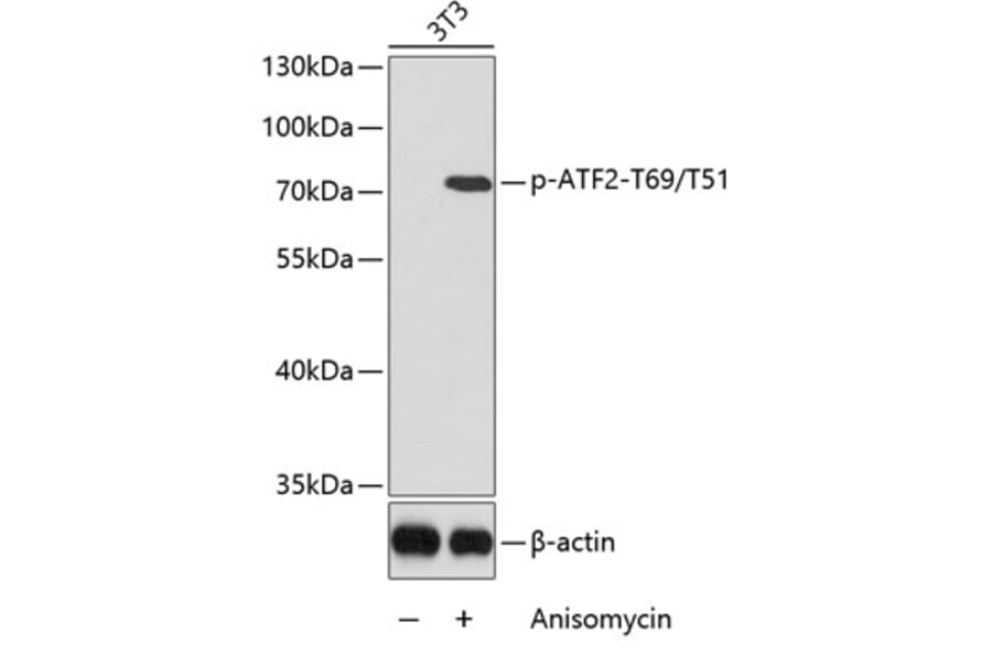 Western Blot - Anti-ATF2 (phospho T69 + T51) Antibody (AP0128) - Antibodies.com