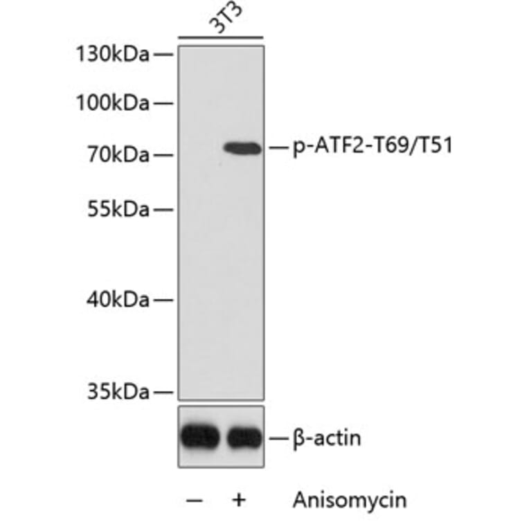 Western Blot - Anti-ATF2 (phospho T69 + T51) Antibody (AP0128) - Antibodies.com