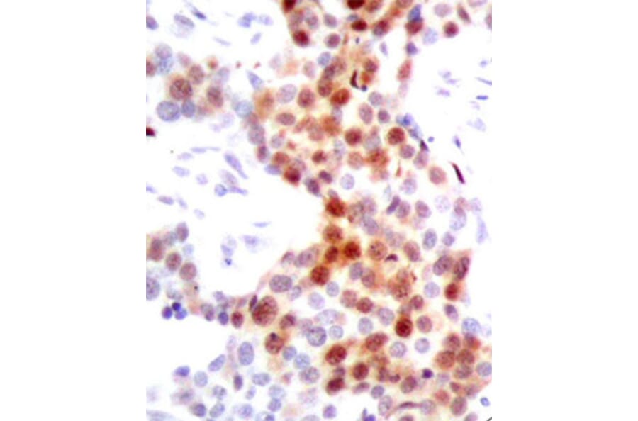 Immunohistochemistry - Anti-ATF2 (phospho T69 + T51) Antibody (AP0128) - Antibodies.com