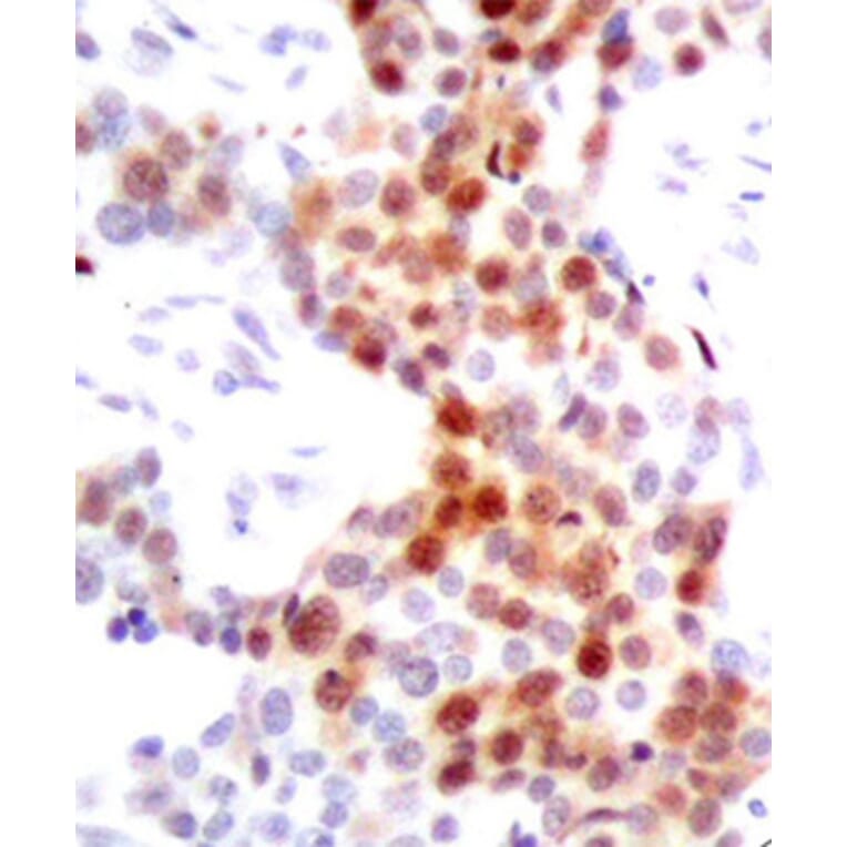Immunohistochemistry - Anti-ATF2 (phospho T69 + T51) Antibody (AP0128) - Antibodies.com