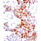 Immunohistochemistry - Anti-ATF2 (phospho T69 + T51) Antibody (AP0128) - Antibodies.com