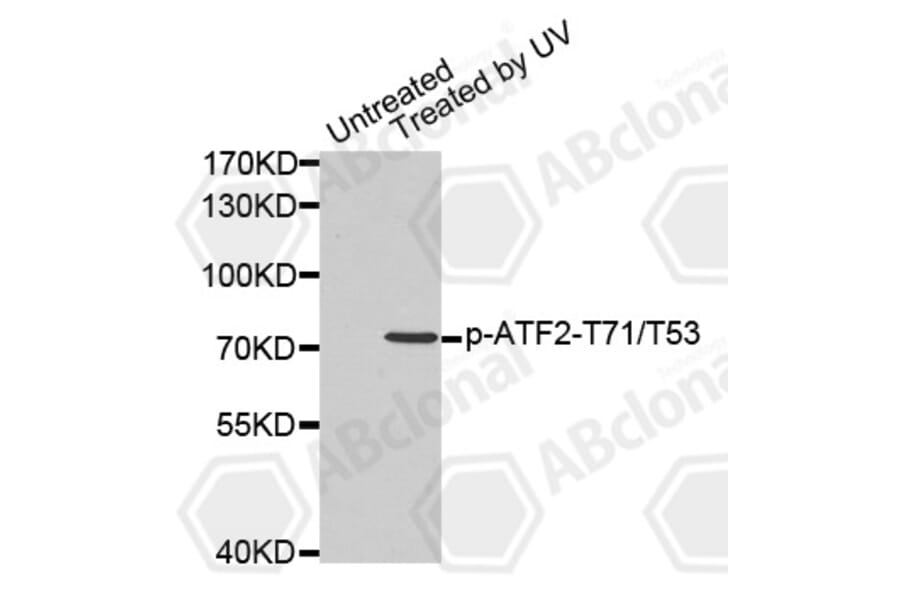 Western Blot - Anti-ATF2 (phospho T71 + T53) Antibody (AP0129) - Antibodies.com