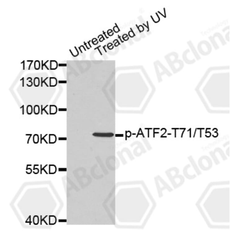 Western Blot - Anti-ATF2 (phospho T71 + T53) Antibody (AP0129) - Antibodies.com