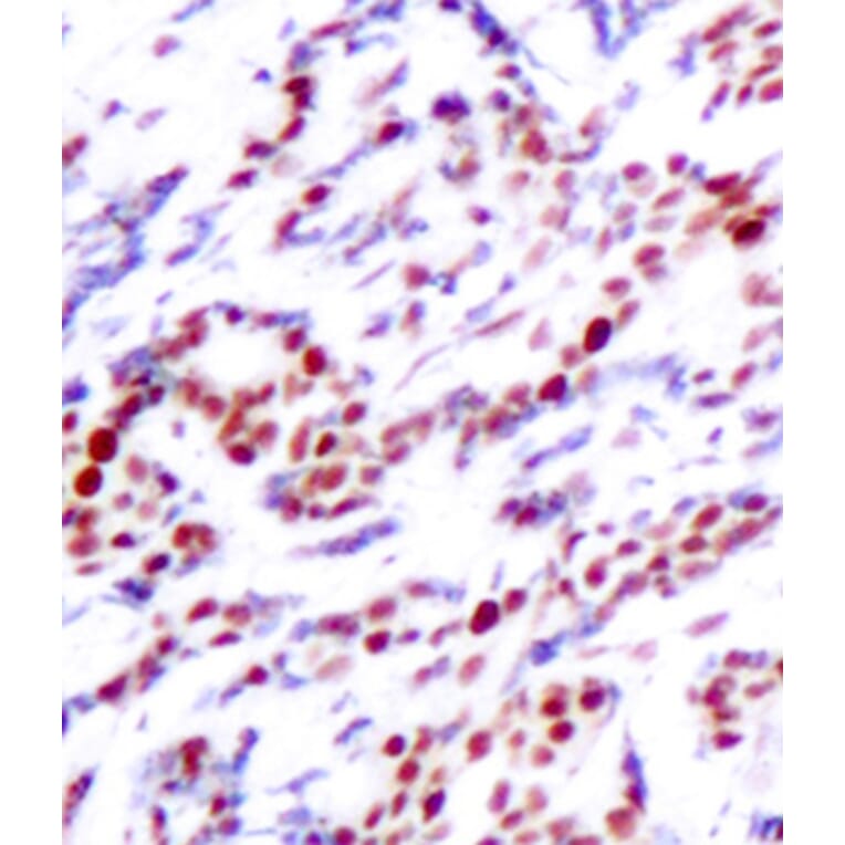 Immunohistochemistry - Anti-ATF2 (phospho T71 + T53) Antibody (AP0129) - Antibodies.com