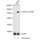 Western Blot - Anti-ATF2 (phospho S112 + S94) Antibody (AP0130) - Antibodies.com