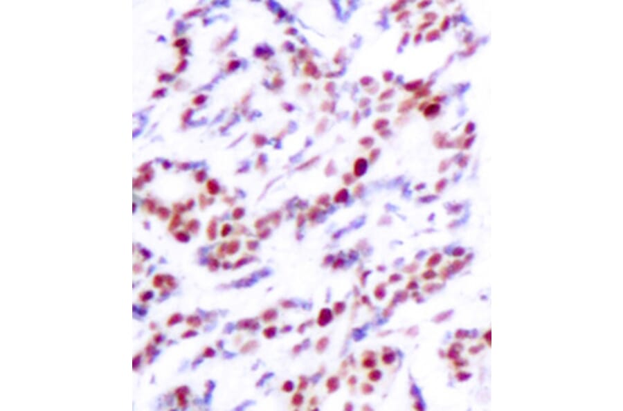 Immunohistochemistry - Anti-ATF2 (phospho S112 + S94) Antibody (AP0130) - Antibodies.com