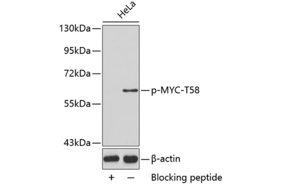 Western Blot - Anti-MYC (phospho T58) Antibody (AP0131) - Antibodies.com