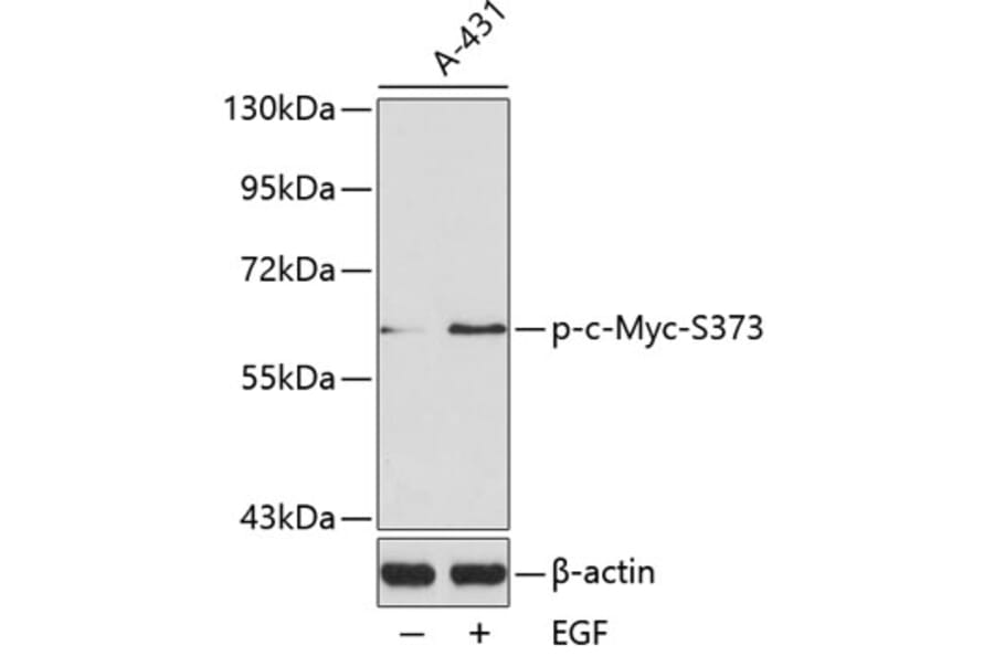 Western Blot - Anti-c-Myc (phospho Ser373) Antibody (A16461) - Antibodies.com