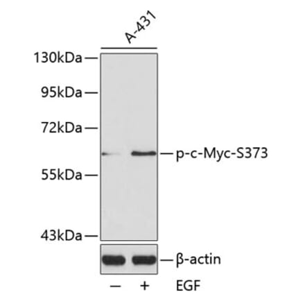 Western Blot - Anti-c-Myc (phospho Ser373) Antibody (A16461) - Antibodies.com