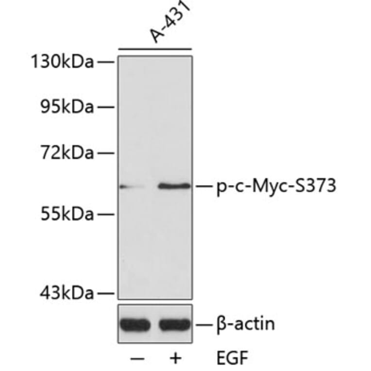 Western Blot - Anti-c-Myc (phospho Ser373) Antibody (A16461) - Antibodies.com