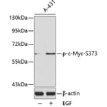 Western Blot - Anti-c-Myc (phospho Ser373) Antibody (A16461) - Antibodies.com