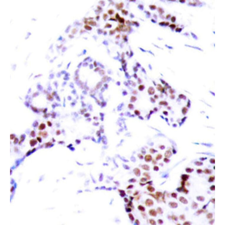 Immunohistochemistry - Anti-ELK1 (phospho S389) Antibody (AP0133) - Antibodies.com