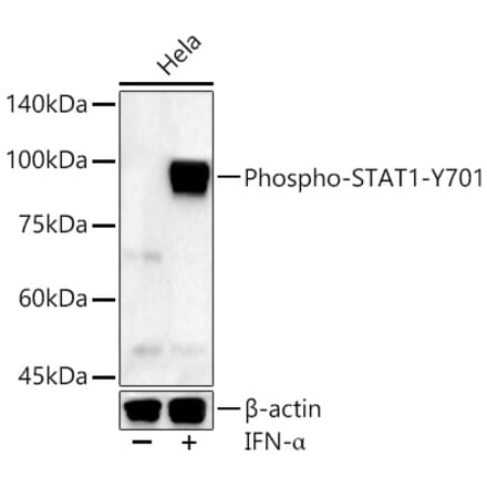 Western Blot - Anti-STAT1 (phospho Tyr701) Antibody (A16463) - Antibodies.com