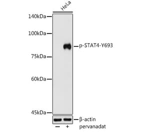 Western Blot - Anti-STAT4 (phospho Tyr693) Antibody (A16465) - Antibodies.com