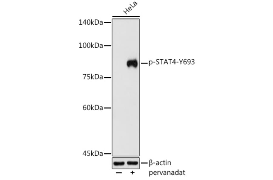 Western Blot - Anti-STAT4 (phospho Tyr693) Antibody (A16465) - Antibodies.com