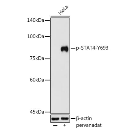 Western Blot - Anti-STAT4 (phospho Tyr693) Antibody (A16465) - Antibodies.com