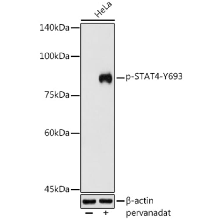 Western Blot - Anti-STAT4 (phospho Tyr693) Antibody (A16465) - Antibodies.com