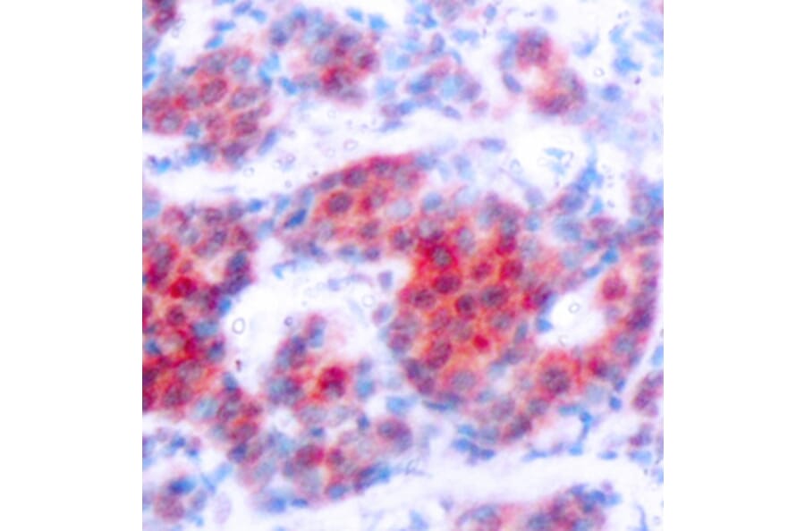 Immunohistochemistry - Anti-STAT4 (phospho Tyr693) Antibody (A16465) - Antibodies.com