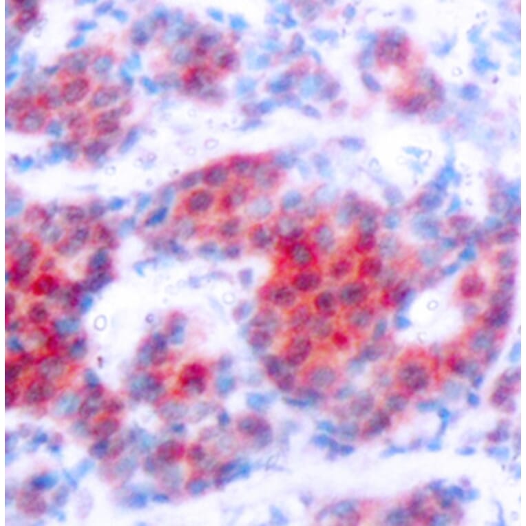 Immunohistochemistry - Anti-STAT4 (phospho Tyr693) Antibody (A16465) - Antibodies.com