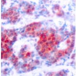 Immunohistochemistry - Anti-STAT4 (phospho Tyr693) Antibody (A16465) - Antibodies.com